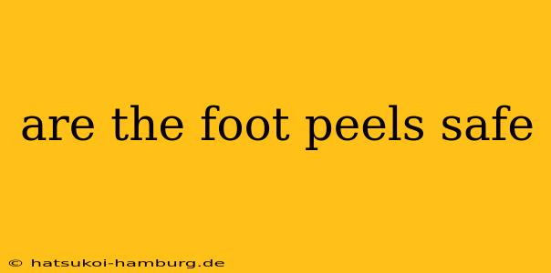 are the foot peels safe