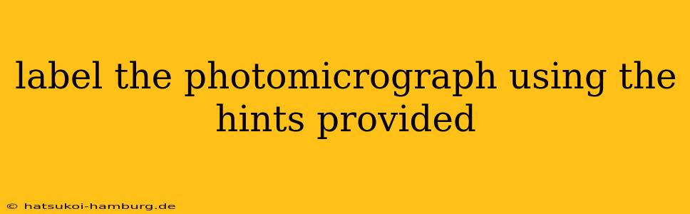 label the photomicrograph using the hints provided