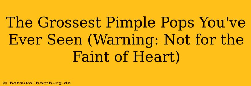 The Grossest Pimple Pops You've Ever Seen (Warning: Not for the Faint of Heart)